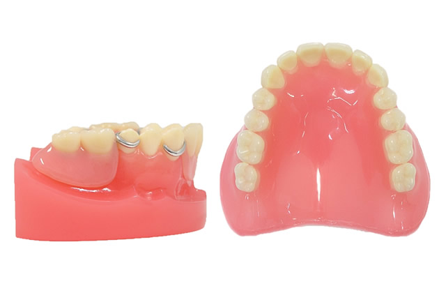 ブリッジ・入れ歯